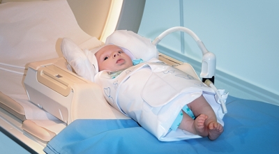 Η αξονική τομογραφία μπορεί να διακρίνει το τυχαίο τραύμα από την κακοποίηση σε βρέφη.