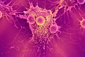 23 Οκτωβρίου 2025, πώς τα mRNA εμβόλια για τον κορωνοϊό βοήθησαν καρκινοπαθείς να ζήσουν ΠΕΡΙΣΣΟΤΕΡΟ